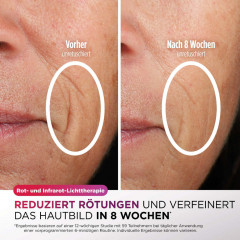 CryoGlow LED-Maske + Kühlung der Augenpartie – FW312EU (Hautpflegemaske) | 36080000996_08
